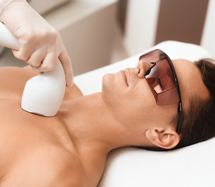 Laser Hair Removal Photo