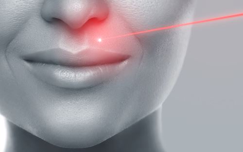 Fractional Laser (CO2 laser) and Melasma: An Additional Treatment Option