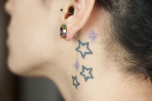 Laser Tattoo Removal Treatment: Don’t Make 2 Bad Decisions!!! Photo