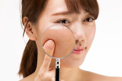 The Ins and Outs of Skin Discoloration Photo