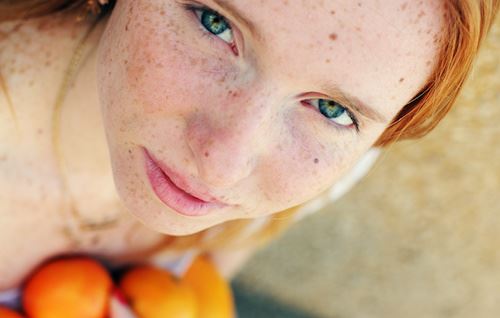 What are the Different Types of Hyperpigmentation? Photo