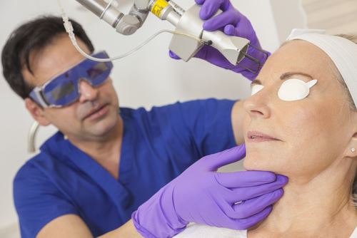 CO2 Laser Treatments for Acne Scar Revision Photo