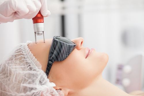 Does Laser Skin Resurfacing Work? Photo