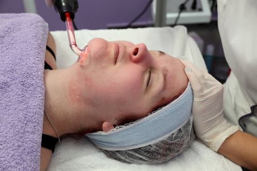 Just How Effective Are Acne Laser Treatments? Photo