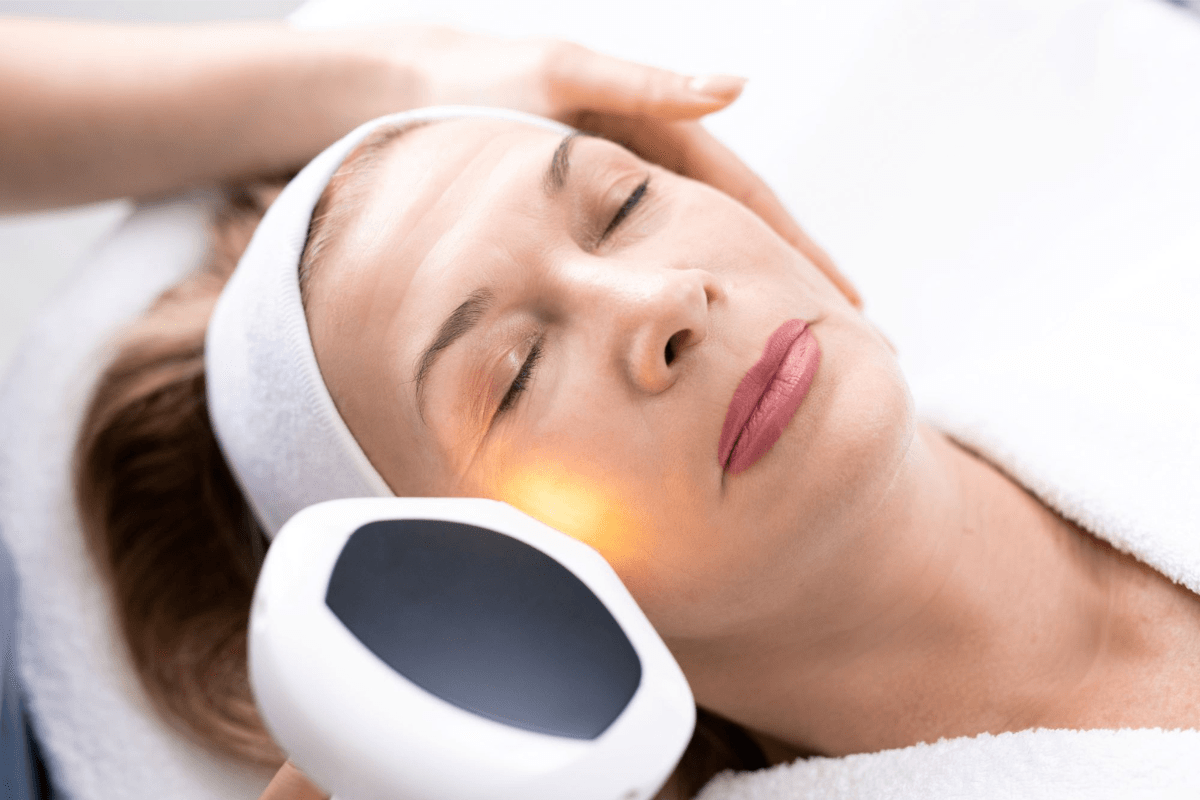 Laser Skin Resurfacing for Acne Scars & Wrinkles: What to Expect Photo