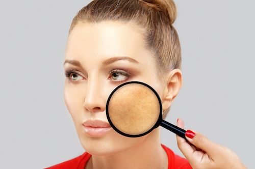 Prevention Tips and a Treatment Option for Melasma Photo