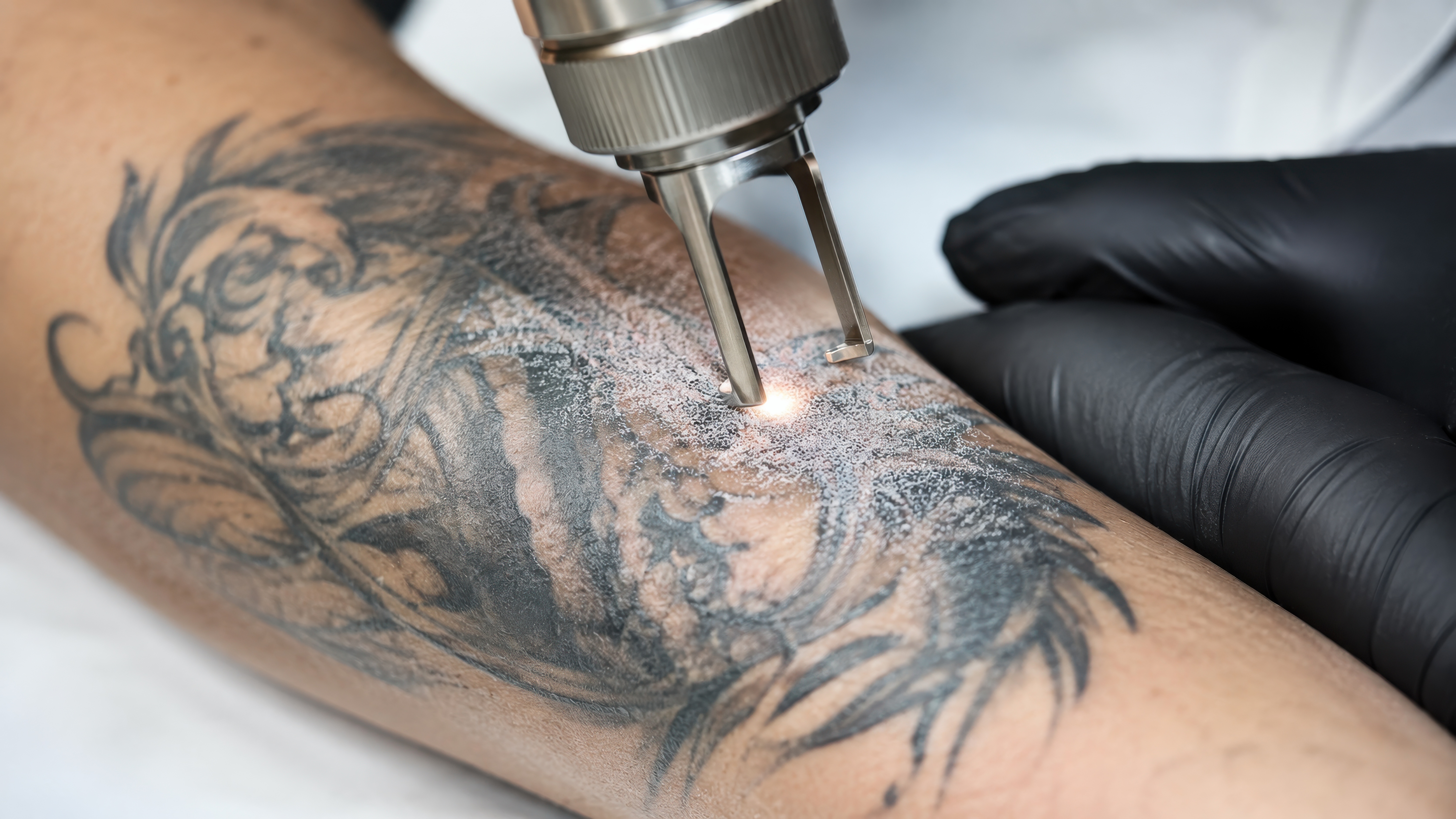 Why Tattoo Artists Recommend Laser Sessions Before a Cover-Up Photo