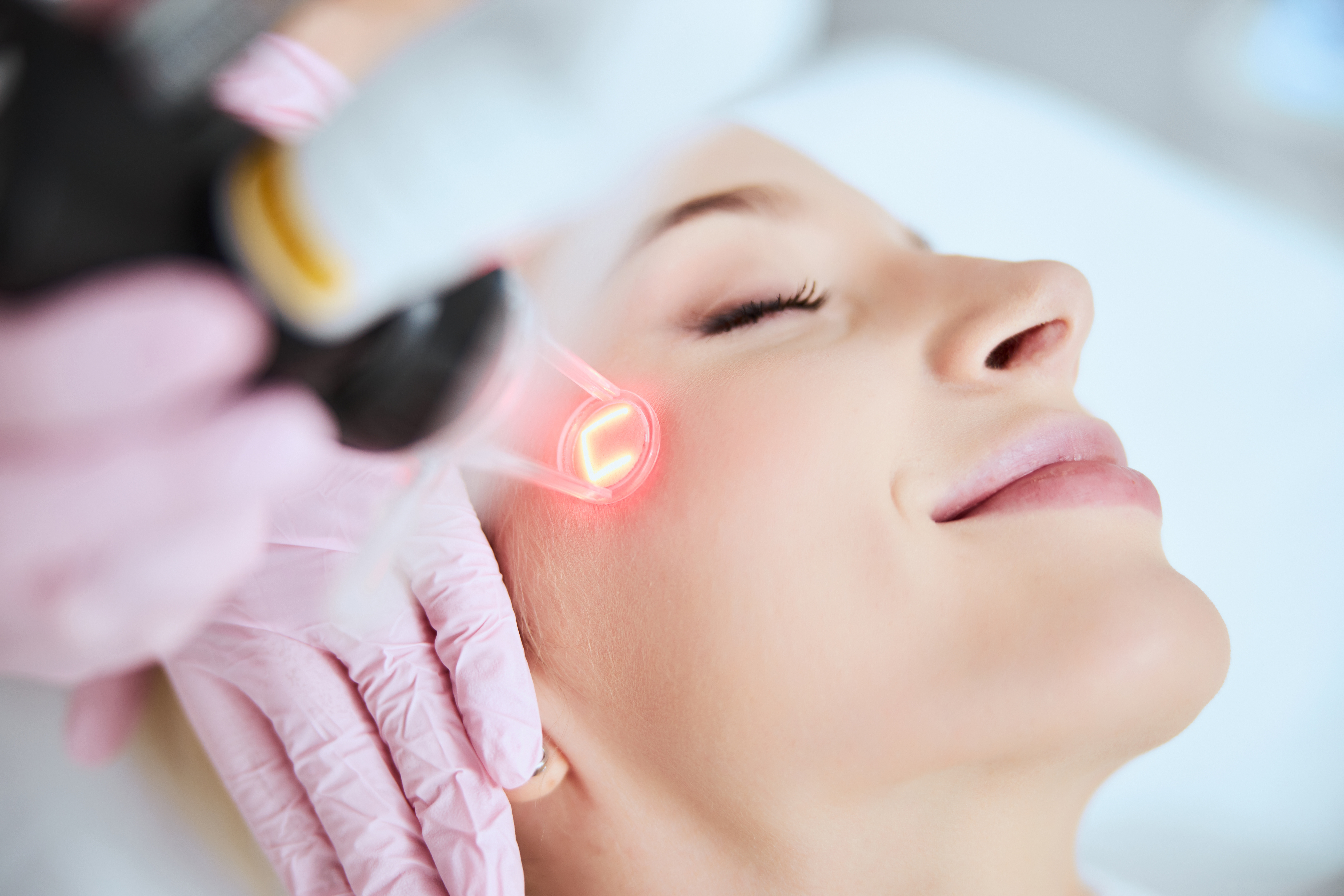 Reveal Your Smoother, Healthier Skin: The Benefits of CO2 Resurfacing Over 40 Photo