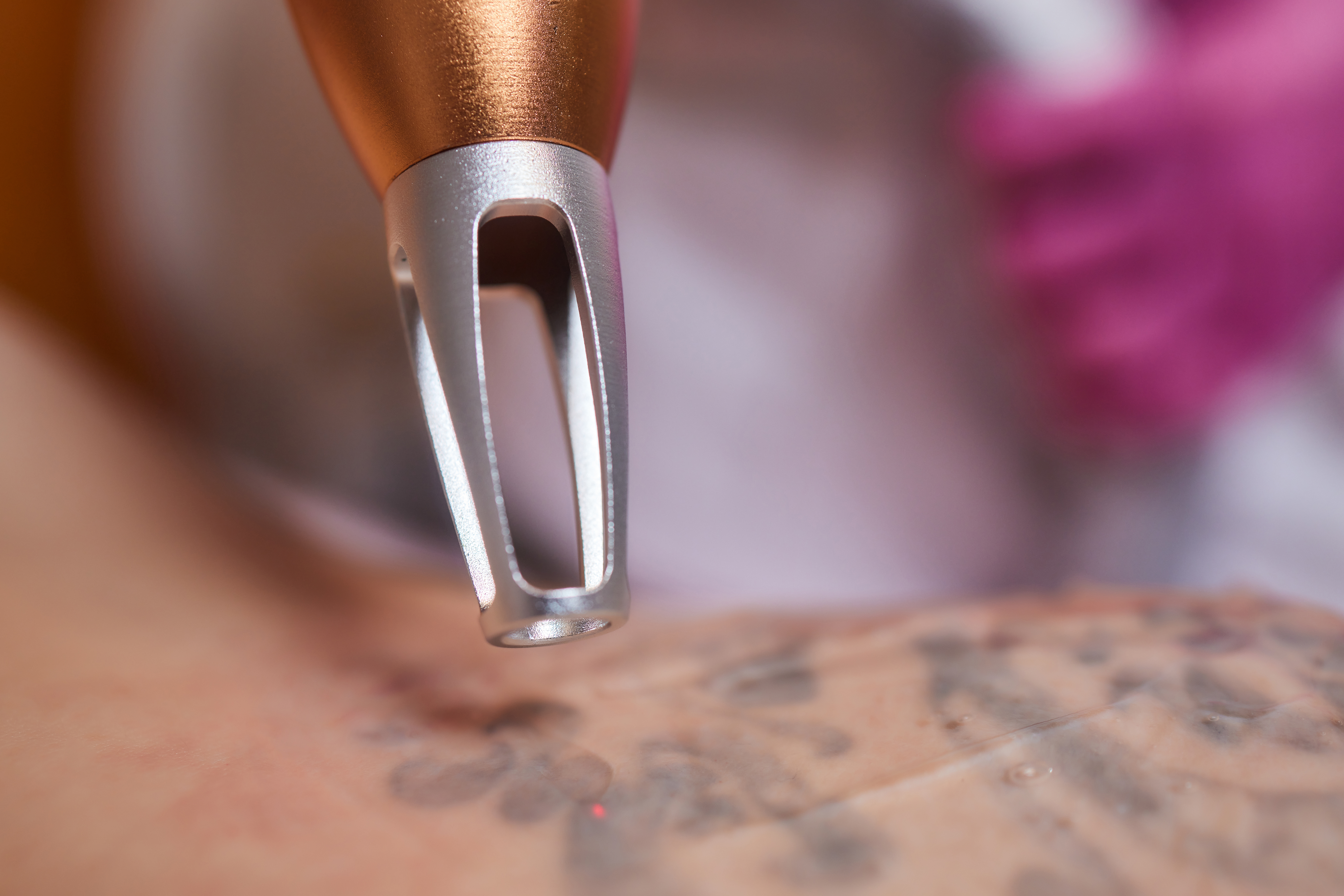 Fall into Great Skin: Why Autumn is the Perfect Time to Start Your Tattoo Removal Journey Photo