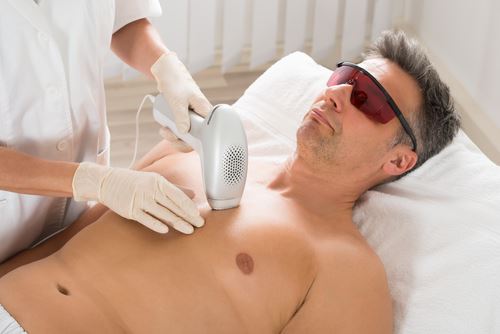 Skin Care Tips After Laser Hair Removal Photo