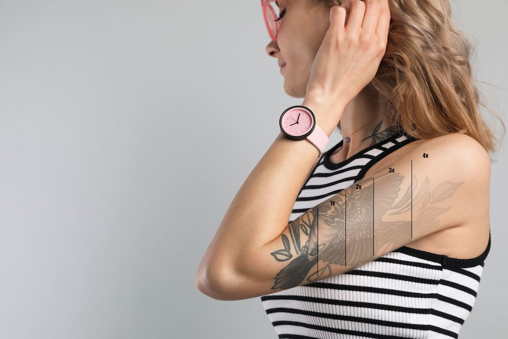 Facts Surrounding Sun Exposure and Laser Tattoo Removal Photo