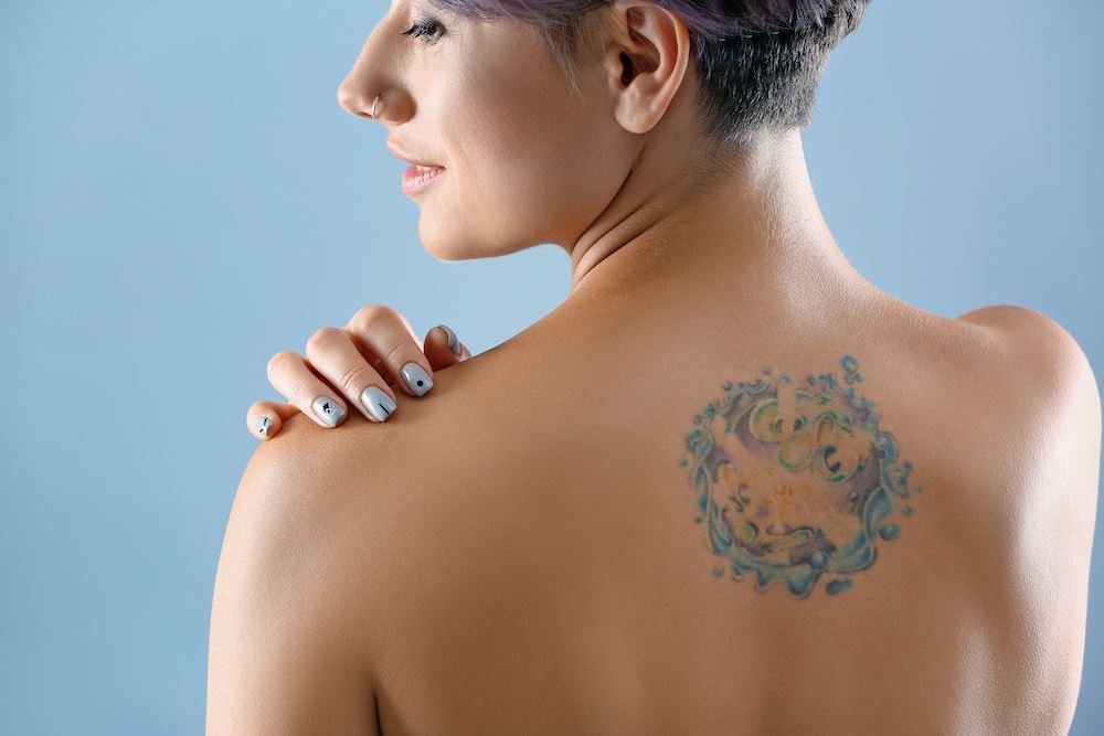 What is the Healing Process for Laser Tattoo Removal? Photo