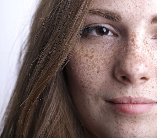 The Different Types of Pigmented Skin Lesions Photo