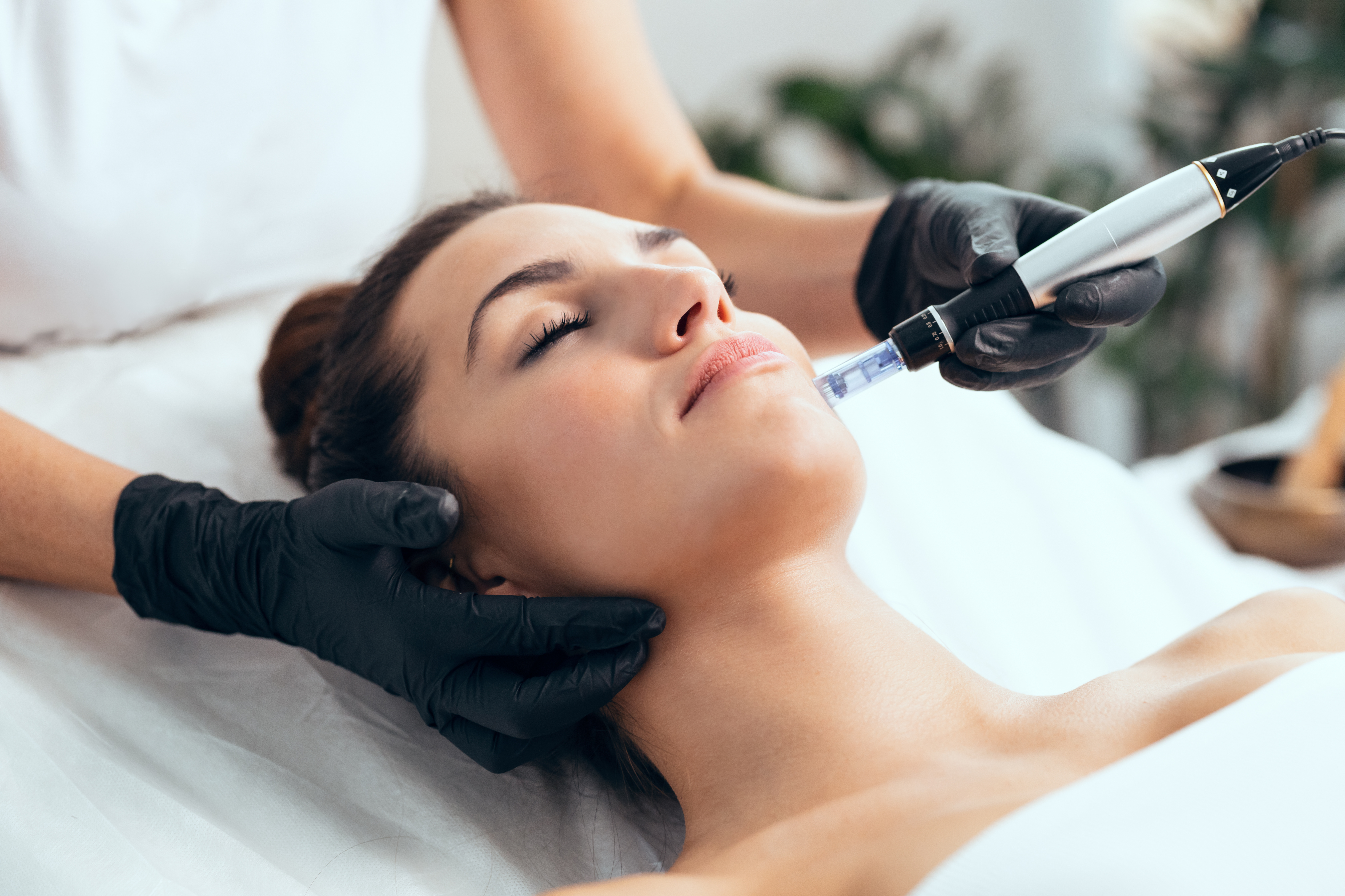 Experience the Virtue RF Difference: Smoother, Tighter Skin Photo