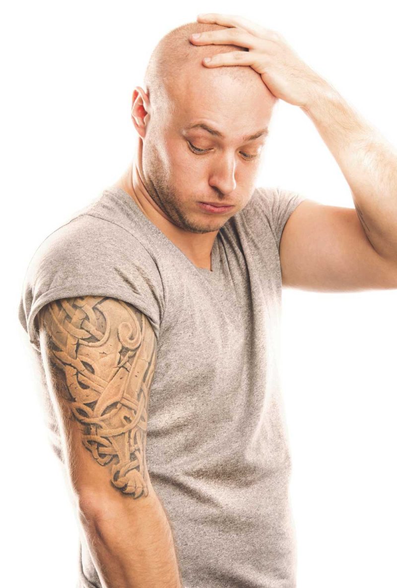 Tattoo Regrets: Remove or Cover Up? Photo