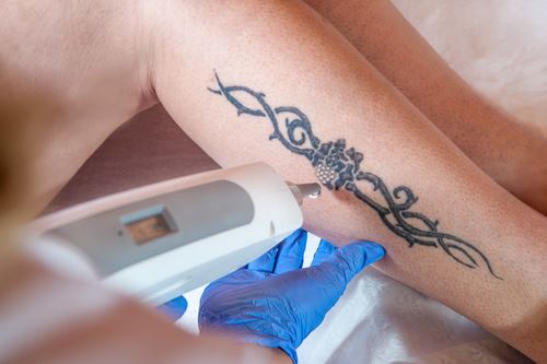 The Truth Behind the Picosure Lawsuit Photo