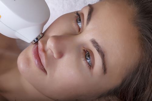 How Much Will My Laser Skin Resurfacing Cost? Photo