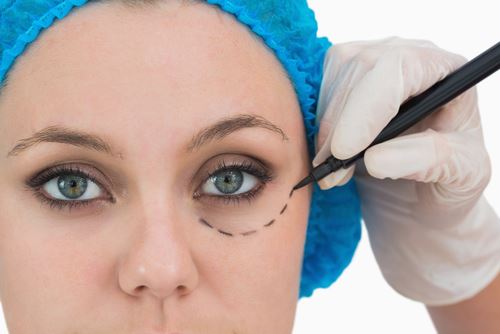 What Can I Expect During My Madonna Eye Lift Procedure? Photo
