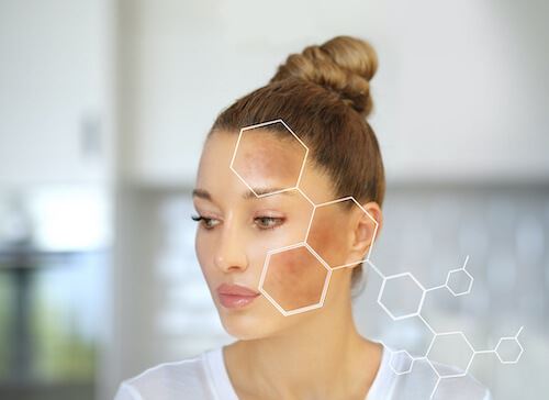 What Could the Dark Spots on Your Skin Be? Photo