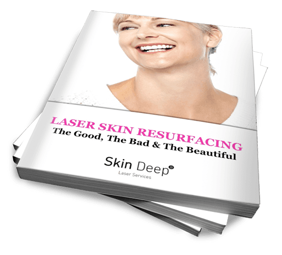 Skindeep eBook – Skin Resurfacing Revised Photo