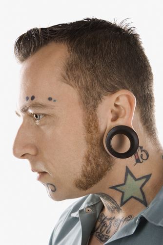 Facial Tattoo Removal: What to Know Before You Go Photo