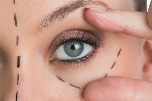 Get Rid of Those Crows Feet With a Madonna Eye Lift! Photo