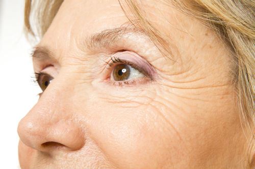 Advantages of Skin Resurfacing with the Fractional CO2 Laser Photo