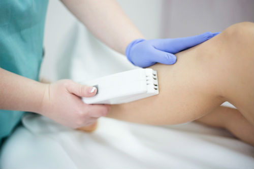 How Long Will One Laser Hair Removal Treatment Last? Photo
