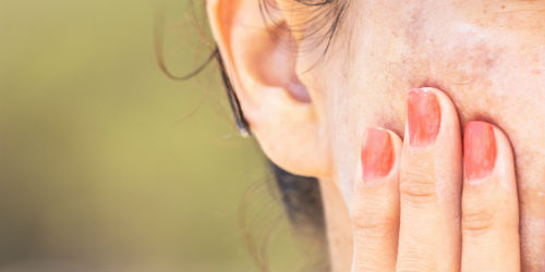 How to Repair Summer Skin Damage Photo