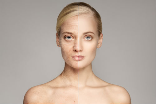 How to Treat Skin That Looks 10 Years Older Than You Photo