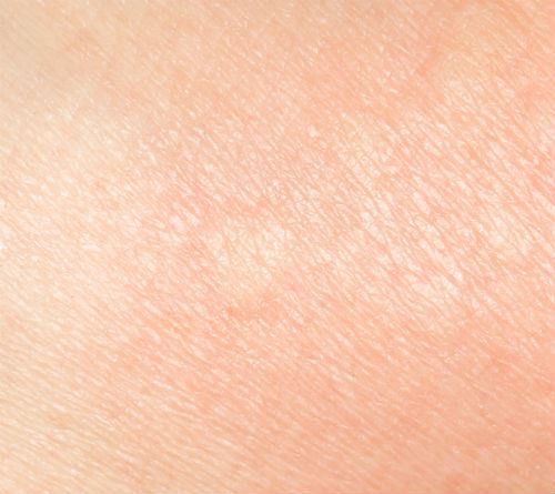 Improve Your Skin Texture with Laser Skin Resurfacing Photo