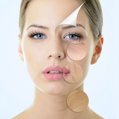 Is CO2 Laser Resurfacing Right for You? Photo