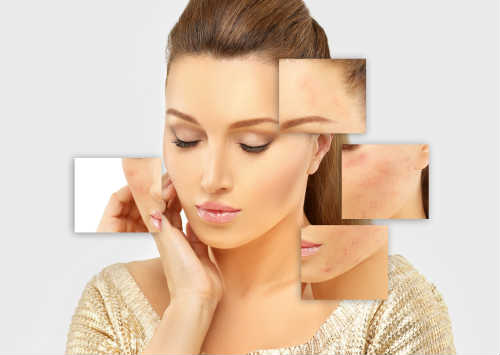 Laser Skin Resurfacing Addresses 3 Common Skin Problems Photo
