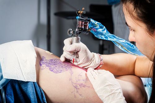 Laser Tattoo Removal is a Breeze Compared to These Activities Photo