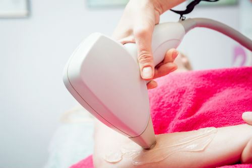 Misconceptions about Laser Hair Removal Photo