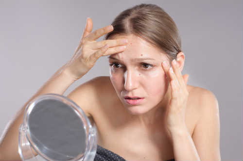 Popular Misconceptions About Acne You May Believe Photo