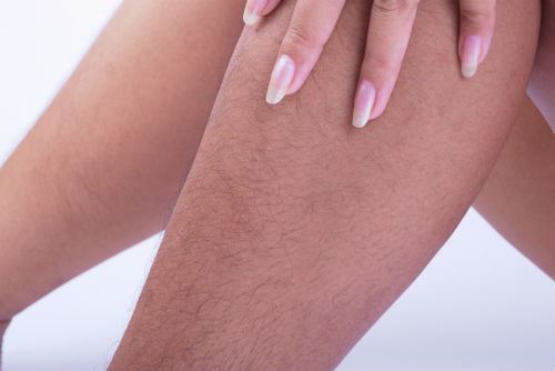 Preparing for a Successful Laser Hair Removal Treatment Photo