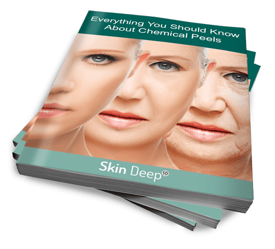Summer 2017 Skindeep eBook – Everything You Should Know About Your Chemical Peel Photo