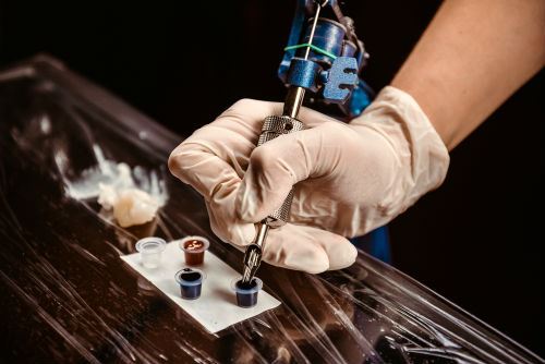 The Facts About Tattoos and Removal Photo