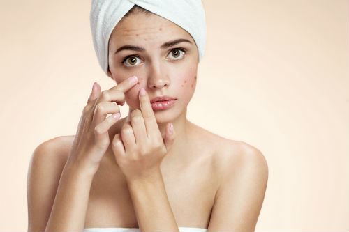 The Real Facts About What Causes Acne Photo