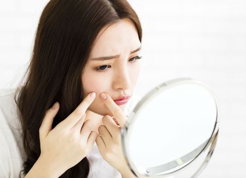 The Right and Wrong Way to Prevent Acne Scars Photo