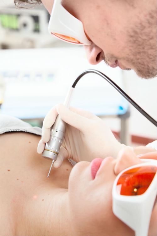 What Procedures Use Fractional Co2 Lasers?