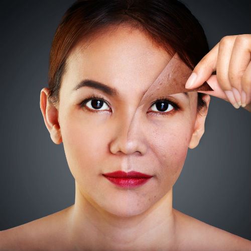When is a Deep Chemical Peel Right for You? Photo